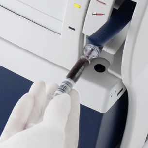 Анализ газов крови